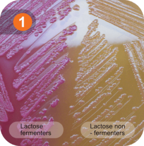 lactose fermenting gram negative rods urine