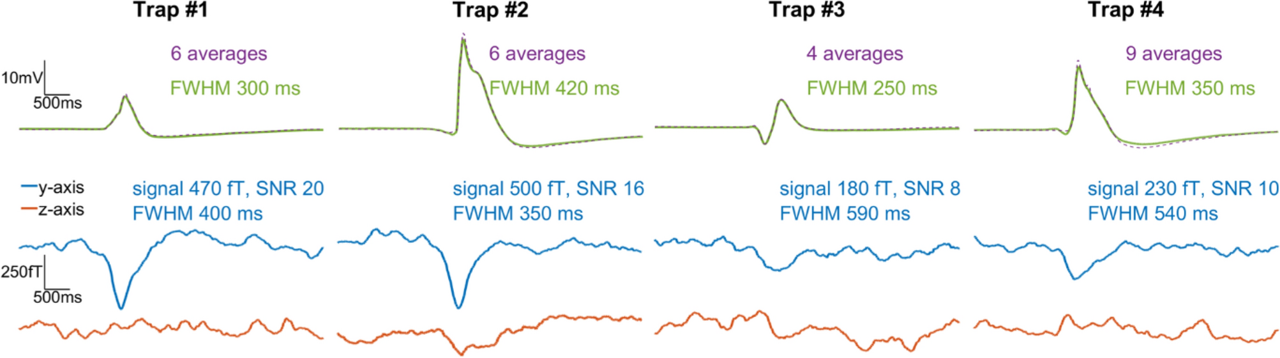 Comparison of electric and gradiometric signals.