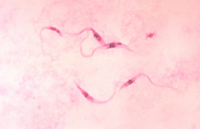 Figure 1. Trypanosoma stained with Giemsa